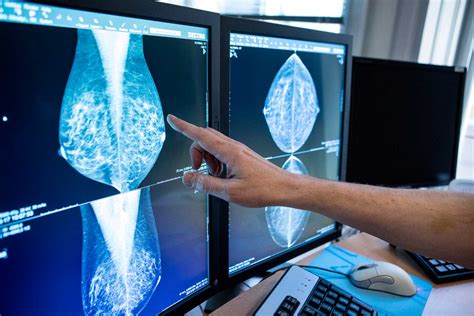 hur ofta mammografi örebro